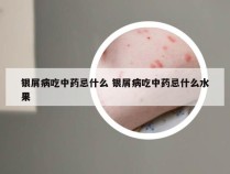 银屑病吃中药忌什么 银屑病吃中药忌什么水果