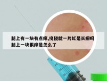 腿上有一块有点痒,挠挠就一片红是长癣吗 腿上一块很痒是怎么了