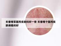 长春哪家医院皮肤科好一些 长春哪个医院皮肤病看的好