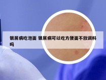 银屑病吃泡面 银屑病可以吃方便面不放调料吗