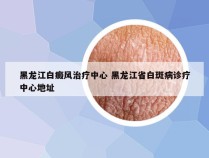 黑龙江白癜风治疗中心 黑龙江省白斑病诊疗中心地址