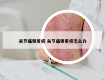 关节痛银屑病 关节痛银屑病怎么办