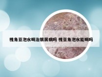 槐角豆泡水喝治银屑病吗 槐豆角泡水能喝吗