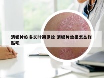 消银片吃多长时间见效 消银片效果怎么样 贴吧