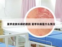 夏季皮肤长癣的原因 夏季长癣是什么情况