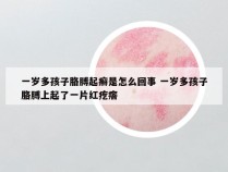 一岁多孩子胳膊起癣是怎么回事 一岁多孩子胳膊上起了一片红疙瘩