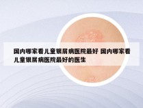 国内哪家看儿童银屑病医院最好 国内哪家看儿童银屑病医院最好的医生