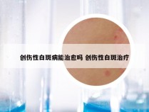 创伤性白斑病能治愈吗 创伤性白斑治疗