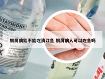 银屑病能不能吃清江鱼 银屑病人可以吃鱼吗