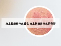 身上起癣用什么香皂 身上长癣用什么药膏好