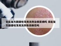 采能复方酮康唑发用洗剂治银屑病吗 采能复方酮康唑发用洗剂有依赖性吗