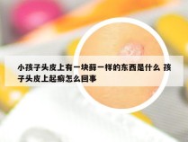 小孩子头皮上有一块藓一样的东西是什么 孩子头皮上起癣怎么回事