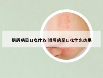 银屑病忌口吃什么 银屑病忌口吃什么水果