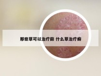 那些草可以治疗藓 什么草治疗癣