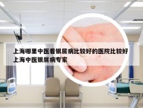 上海哪里中医看银屑病比较好的医院比较好 上海中医银屑病专家