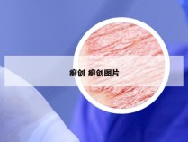 癣创 癣创图片