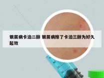 银屑病卡泊二醇 银屑病擦了卡泊三醇为好久起效