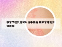 联苯苄唑乳膏可以治牛皮癣 联苯苄唑乳膏 银屑病