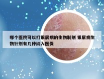 哪个医院可以打银屑病的生物制剂 银屑病生物针剂有几种纳入医保