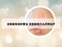 皮肤癣有啥好要治 皮肤癣用什么药物治疗