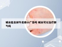 碱水能去掉牛皮癣小广告吗 碱水可以治疗脚气吗