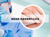 顽固皮藓 顽固皮癣用什么药膏