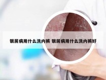 银屑病用什么洗内裤 银屑病用什么洗内裤好