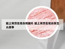 腿上突然出现白斑图片 腿上突然出现白斑怎么回事