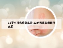 12岁小孩头癣怎么治 12岁男孩头癣用什么药