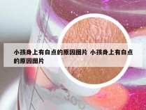 小孩身上有白点的原因图片 小孩身上有白点的原因图片