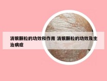 消银颗粒的功效和作用 消银颗粒的功效及主治病症