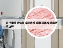 治疗银屑病信誉成都润禾 成都润禾皮肤病医院口碑