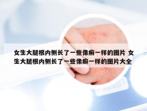 女生大腿根内侧长了一些像癣一样的图片 女生大腿根内侧长了一些像癣一样的图片大全