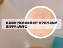 银屑病西宁那冢医院看的好 西宁治疗皮肤病医院哪家比较好走