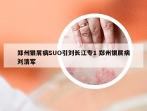 郑州银屑病SUO引刘长江专1 郑州银屑病刘清军