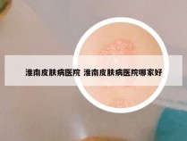 淮南皮肤病医院 淮南皮肤病医院哪家好