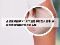 点滴性银削病3个月了还是不好怎么回事 点滴型银屑病好转征兆怎么样