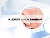 身上起癣需要验什么血 看癣用抽血吗