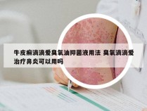 牛皮癣滴滴爱臭氧油抑菌液用法 臭氧滴滴爱治疗鼻炎可以用吗