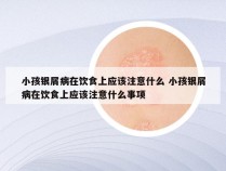 小孩银屑病在饮食上应该注意什么 小孩银屑病在饮食上应该注意什么事项