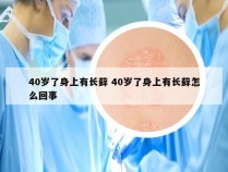 40岁了身上有长藓 40岁了身上有长藓怎么回事