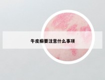 牛皮癣要注意什么事项