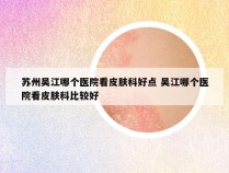 苏州吴江哪个医院看皮肤科好点 吴江哪个医院看皮肤科比较好