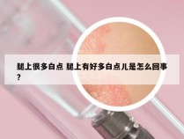 腿上很多白点 腿上有好多白点儿是怎么回事?