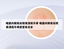 嘴唇内侧有白斑像溃疡不疼 嘴唇内侧有白斑像溃疡不疼感觉有点佘