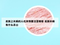 皮肤上长癣的人吃食物要注意哪些 皮肤长癣有什么忌口