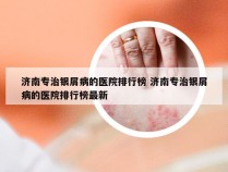 济南专治银屑病的医院排行榜 济南专治银屑病的医院排行榜最新