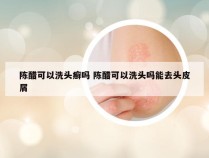 陈醋可以洗头癣吗 陈醋可以洗头吗能去头皮屑