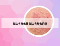 腿上有红色藓 腿上有红色的藓