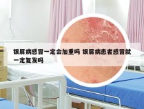 银屑病感冒一定会加重吗 银屑病患者感冒就一定复发吗